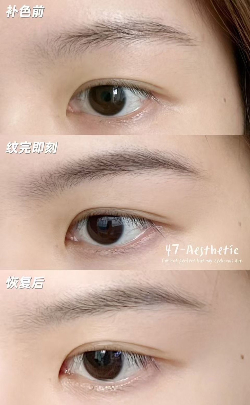 四七美学纹眉补色前、纹完即刻与恢复后